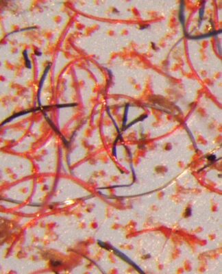Microscope image of the tiny fibres that shed from garments over their lifetime. © Mathew Watkins, Patagonia