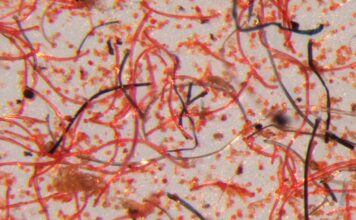 Microscope image of the tiny fibres that shed from garments over their lifetime. © Mathew Watkins, Patagonia