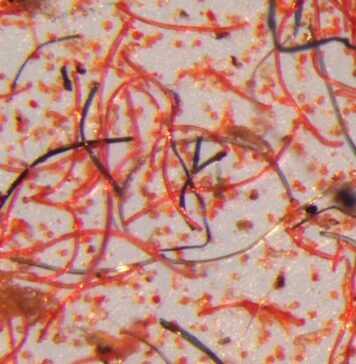 Microscope image of the tiny fibres that shed from garments over their lifetime. © Mathew Watkins, Patagonia