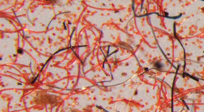 Microscope image of the tiny fibres that shed from garments over their lifetime. © Mathew Watkins, Patagonia